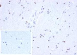 Immunohistochemical analysis of formalin-fixed, paraffin-embedded human brain using Anti-OLIG2 Antibody [OLIG2/6695R] at 2µg/ml in PBS for 30 minutes at room temperature. Inset: PBS instead of the primary antibody. Secondary antibody negative control.