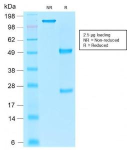 SDS-PAGE analysis of Anti-EpCAM Antibody [rEGP40/1110] under non-reduced and reduced conditions; showing intact IgG and intact heavy and light chains, respectively. SDS-PAGE analysis confirms the integrity and purity of the antibody