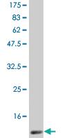 Anti-CSF2 Mouse Monoclonal Antibody [clone: 1D6]