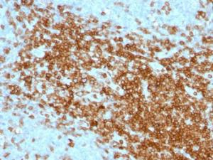 Immunohistochemical analysis of formalin-fixed, paraffin-embedded human tonsil using Anti-CD43 Antibody [SPN/1094]