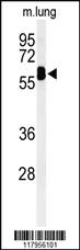 Anti-EHD3 Rabbit Polyclonal Antibody