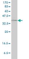 Anti-RAD51C Mouse Monoclonal Antibody [clone: 3F3-5C6]