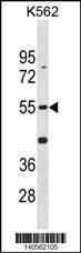 Anti-CDK14 Rabbit Polyclonal Antibody (FITC (Fluorescein Isothiocyanate))