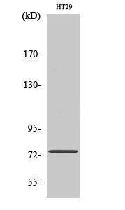 Western blot analysis of HT29 cells using Anti-ACSS1 Antibody