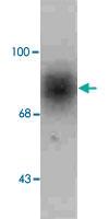 Anti-SLC6A3 Rabbit Polyclonal Antibody