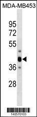 Anti-PBK Rabbit Polyclonal Antibody (APC (Allophycocyanin))