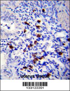 Anti-TNN Rabbit Polyclonal Antibody (Biotin)