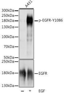 Western blot analysis of extracts of A-431 cells, using Goat Anti-Porcine IgG H&L Antibody (HRP) (A17359) at 1:1,000 dilution or EGFR antibody (A11351) A-431 cells were treated by EGF (100 ng/ml) at 37°C for 30 minutes after serum-starvation overnight