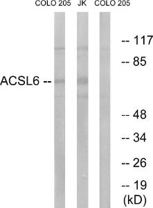 Western blot analysis of lysates from COLO and Jurkat cells using Anti-ACSL6 Antibody. The right hand lane represents a negative control, where the antibody is blocked by the immunising peptide.