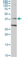 Anti-RAD51C Mouse Monoclonal Antibody [clone: 3F3-5C6]