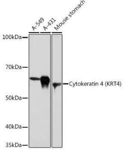 Western blot analysis of extracts of various cell lines, using Anti-Cytokeratin 4 Antibody [ARC1804] (A307427) at 1:1,000 dilution. The secondary antibody was Goat Anti-Rabbit IgG H&L Antibody (HRP) at 1:10,000 dilution.