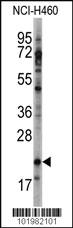 Anti-HAND2 Rabbit Polyclonal Antibody