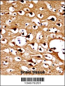 Anti-NUMBL Rabbit Polyclonal Antibody (Biotin)