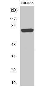 Western blot analysis of various cells using Anti-ACSL6 Antibody