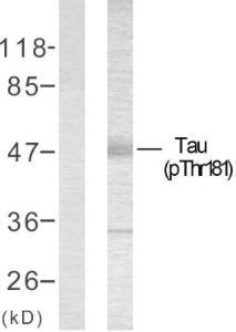 Western blot analysis of lysates from mouse brain using Anti-Tau (phospho Thr181) Antibody. The left hand lane represents a negative control, where the antibody is blocked by the immunising peptide