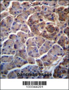 Anti-MOSPD2 Rabbit Polyclonal Antibody