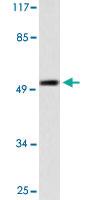 Anti-CK7 Rabbit Polyclonal Antibody