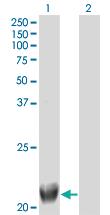 Anti-TRIML1 Mouse Monoclonal Antibody [clone: 4F8]