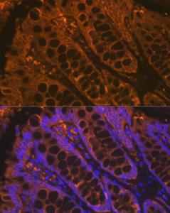 Immunofluorescence analysis of rat rectum using Anti-Cytokeratin 4 Antibody [ARC1804] (A307427) at a dilution of 1:100 (40x lens). DAPI was used to stain the cell nuclei (blue).