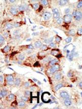 Anti-TRDMT1 Rabbit Polyclonal Antibody