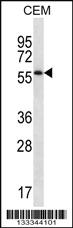 Anti-MOSPD2 Rabbit Polyclonal Antibody