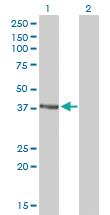 Anti-RAD51C Mouse Monoclonal Antibody [clone: 3F3-5C6]