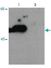 Anti-PARK2 Rabbit Polyclonal Antibody