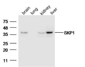 Anti-SKP1 Rabbit Polyclonal Antibody