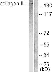 Western blot analysis of lysates from COLO205 cells using Anti-Collagen II Antibody The right hand lane represents a negative control, where the antibody is blocked by the immunising peptide