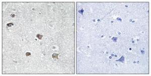 Immunohistochemical analysis of paraffin-embedded human brain using Anti-ACSL6 Antibody 1:100 (4°C overnight). The right hand panel represents a negative control, where the antibody was pre-incubated with the immunising peptide.