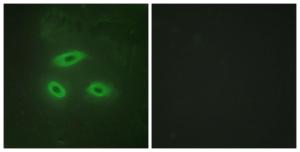 Immunofluorescence analysis of HeLa cells using Anti-NKTR Antibody. The right hand panel represents a negative control, where the antibody was pre-incubated with the immunising peptide