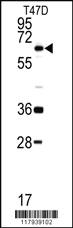 Anti-DDX5 Rabbit Polyclonal Antibody