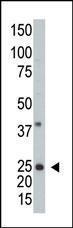 Anti-ARL3 Rabbit Polyclonal Antibody (APC (Allophycocyanin))