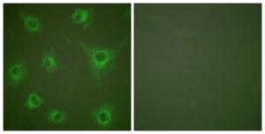 Immunofluorescence analysis of COS7 cells using Anti-Collagen II Antibody The right hand panel represents a negative control, where the antibody was pre-incubated with the immunising peptide