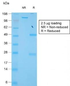 Antibody anti-TIMP1 TIMP11944R 100 µg