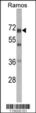 Anti-DDX5 Rabbit Polyclonal Antibody