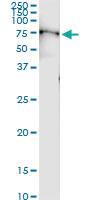 Anti-MPL Polyclonal Antibody Pair