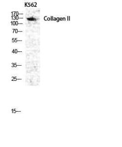 Western blot analysis of various cells using Anti-Collagen II Antibody