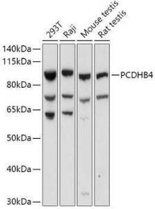 Western blot analysis of extracts of various cell lines, using Anti-PCDHB4 Antibody (A305773) at 1:1,000 dilution