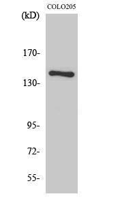 Western blot analysis of COLO205 cells using Anti-Collagen II Antibody