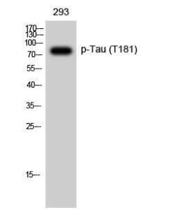 Western blot analysis of 293 cells using Anti-Tau (phospho Thr181) Antibody