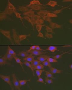 Immunofluorescence analysis of NIH/3T3 cells using Anti-NF-kB p65 Antibody (A80443) at a dilution of 1:100 (40X lens). DAPI was used to stain the cell nuclei (blue)