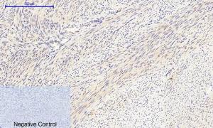 Immunohistochemical analysis of paraffin-embedded human uterus tissue using Anti-Collagen II Antibody at 1:200 (4°C overnight) Negative control was secondary antibody only