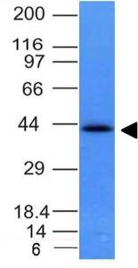 Western blot analysis of HCT116 cell lysate using Anti-EpCAM Antibody [EGP40/837]