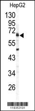 Anti-AGR2 Rabbit Polyclonal Antibody