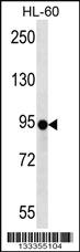 Anti-ZNF227 Rabbit Polyclonal Antibody