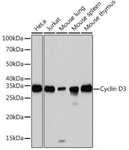 Anti-Cyclin D3 / CCND3 Rabbit Monoclonal Antibody [clone: ARC0325]