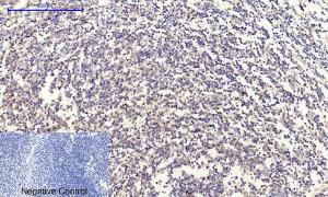 Immunohistochemical analysis of paraffin-embedded human Tonsil tissue using Anti-Collagen II Antibody at 1:200 (4°C overnight) Negative control was secondary antibody only