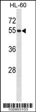 Anti-UBA3 Rabbit Polyclonal Antibody