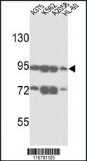 Anti-ABCB5 Rabbit Polyclonal Antibody